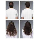 Loreal Serioxyl Advanced Denser Hair Serum For Thinning Hair (Canada) – visible hair density improvement | Hair Care Canada