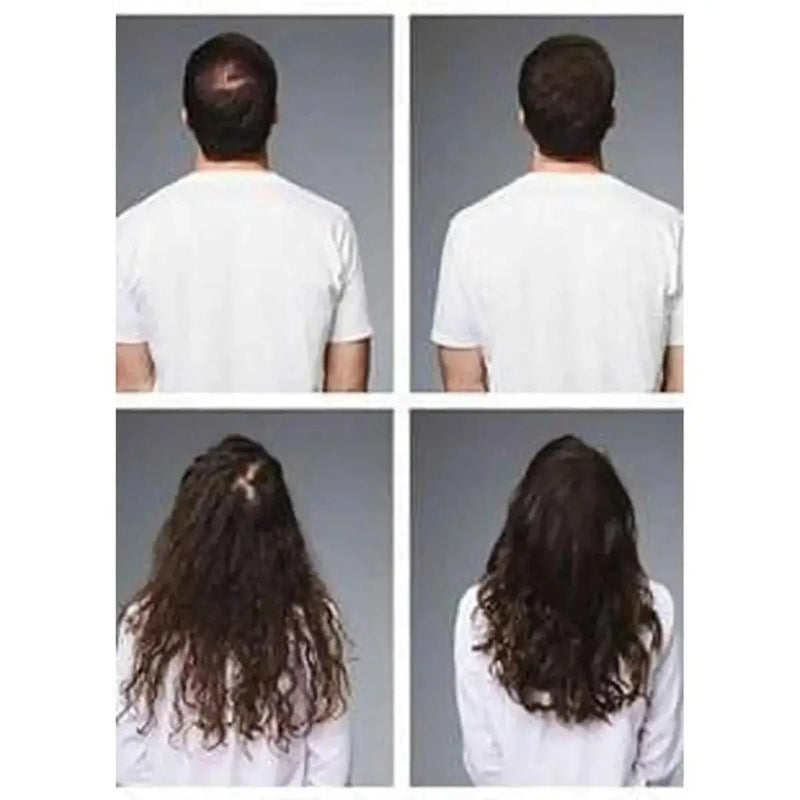 Loreal Serioxyl Advanced Denser Hair Serum For Thinning Hair (Canada) – visible hair density improvement | Hair Care Canada